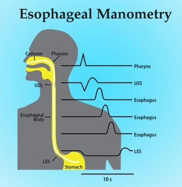 Esophageal Manometry