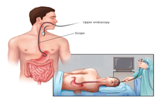 Endoscopy