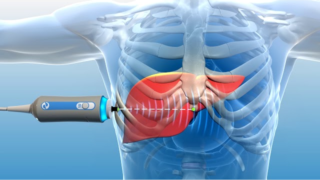 Dr. Vinit Kahalekar Gastroenterologist in Aurangabad
